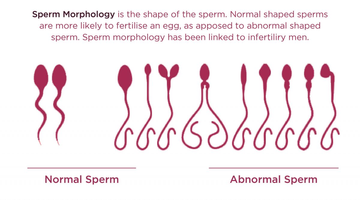 How To Read A Sperm Analysis Report