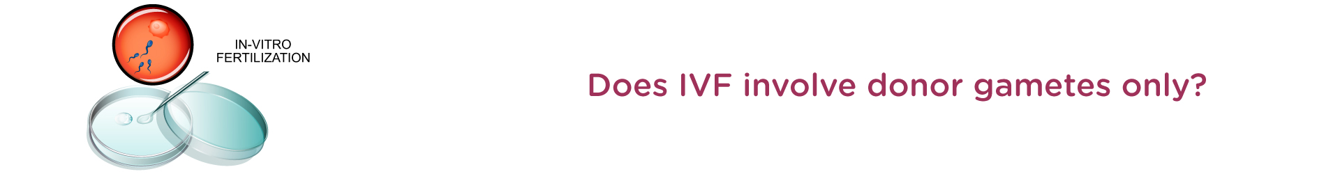 Does IVF involve donor gametes only?