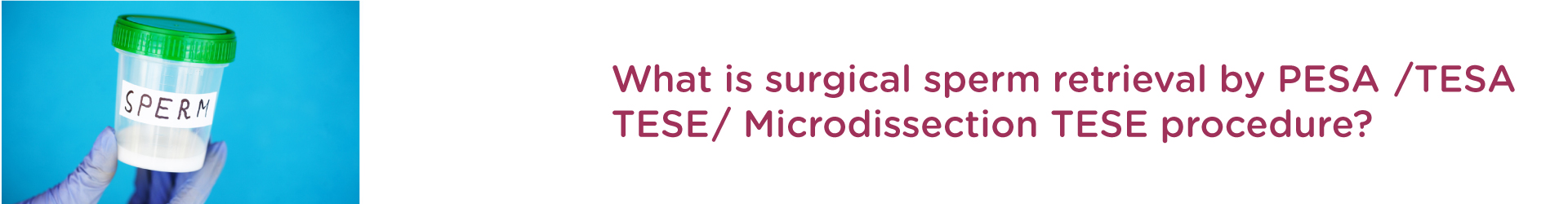 What is Surgical Sperm Retrieval By PESA/TESA/TESE/Microdissection TESE procedure?