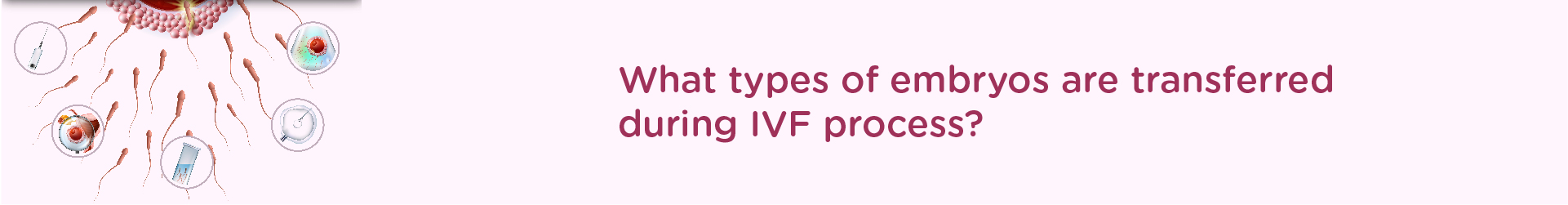 What Types of Embryos are Transferred During IVF Process?