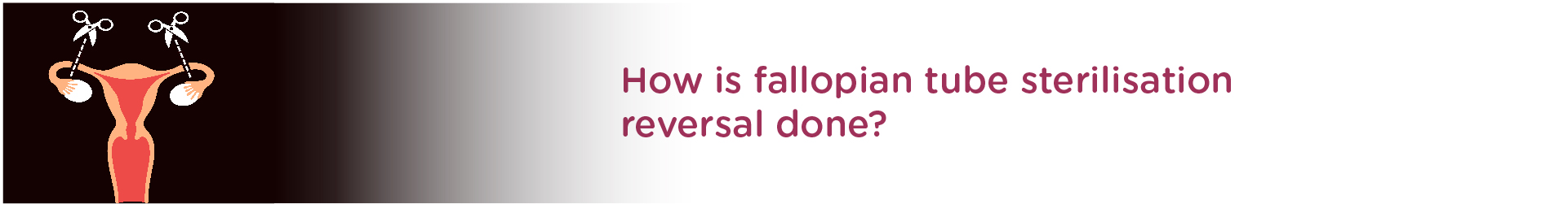 How is Fallopian Tube Sterilization Reversal Done?